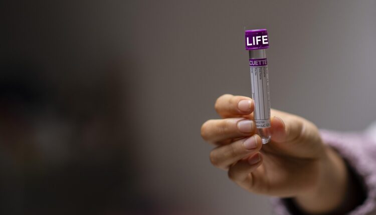 KY: o que significa e onde é usado